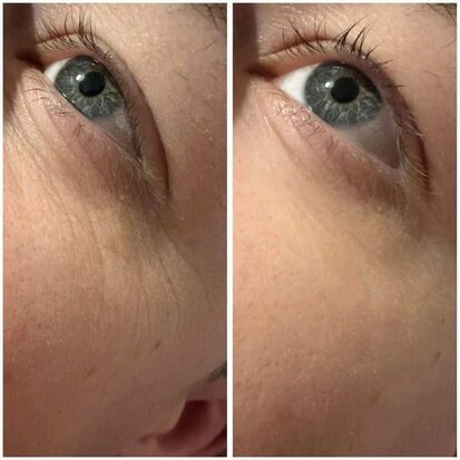 Farmasi | Age Reversist | Botox in een zakje! | Verminderd lijntjes | Anti Aging effect | Anti rimpel! | Direct effect tot wel 8 uur lang! | Botox Creme | Let op: 5 losse zakjes!